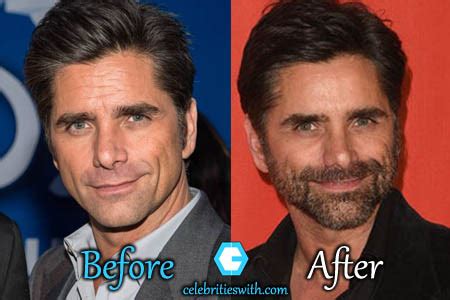 john stamos nose job